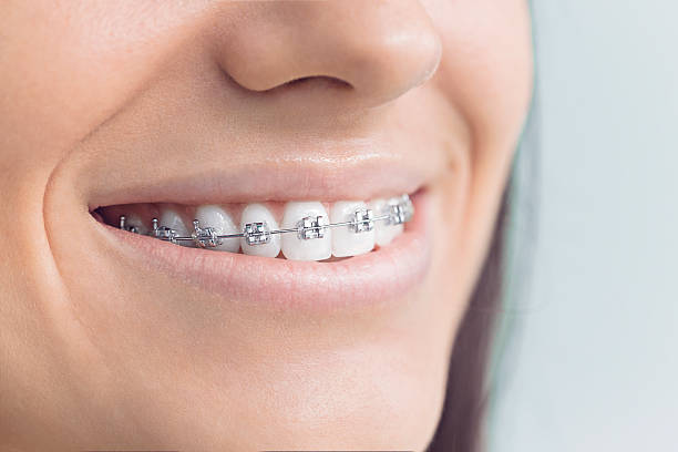 Best Tooth Extraction  in Divernon, IL
